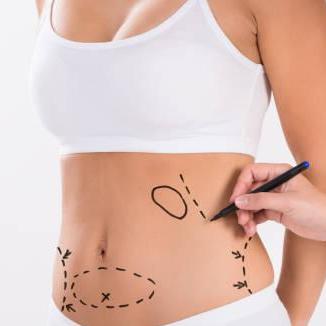 Liposuction Procedure  In Riyadh