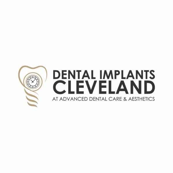 Dental  Implants Cleveland