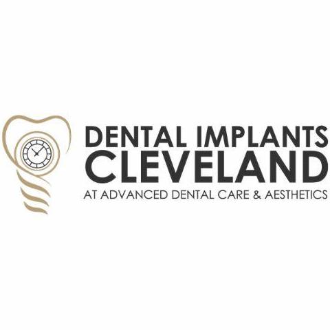 Dental Implants  Cleveland
